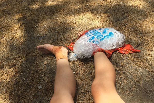 Injury By Mile 50 – What Limping Has Taught Me