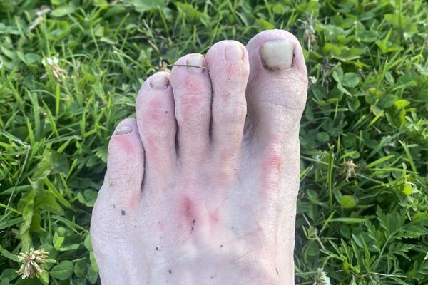 Why Thru Hiking the AT Sucks