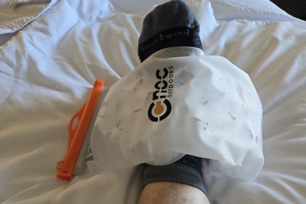 Day 42: Nothing is Wrong, My Foot’s Just Old