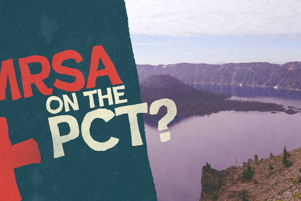 The Last Thing I Expected on My PCT Hike: Contracting MRSA
